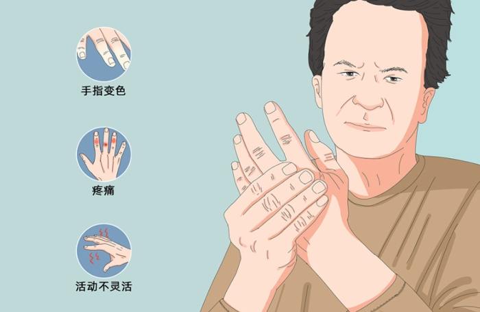 突然手麻原因 突然手麻原因