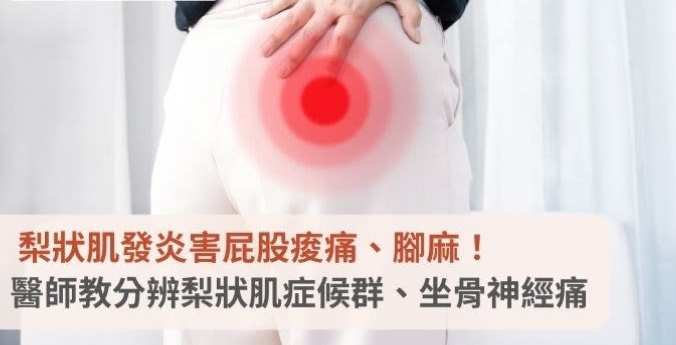 梨狀肌症候群 梨狀肌症候群