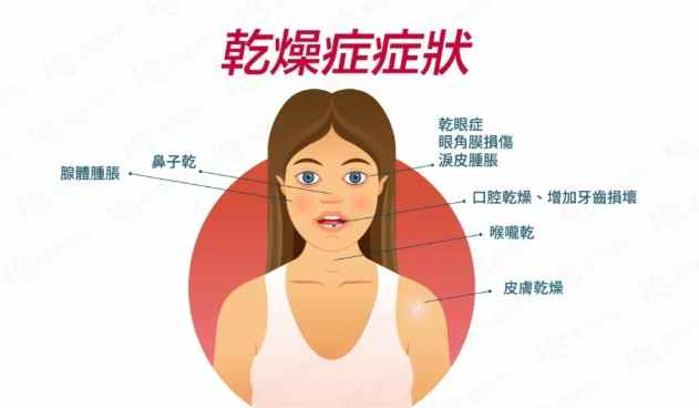 唾液腺炎治療 唾液腺炎治療