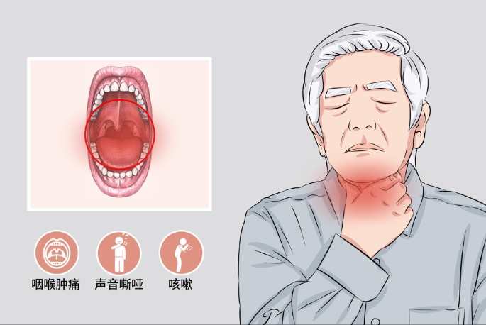 咽喉炎恢復時間 咽喉炎恢復時間