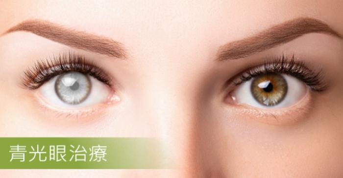 青光眼失明治療 青光眼失明治療