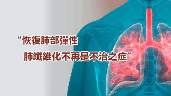 肺纖維化治療 肺纖維化治療