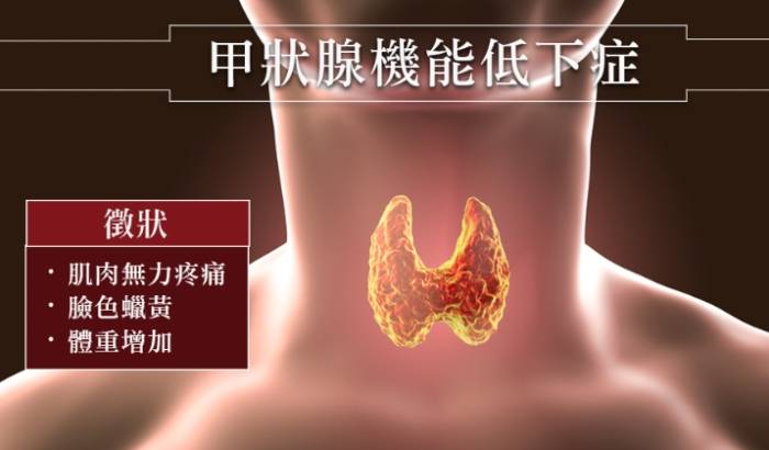 甲狀腺低下治療