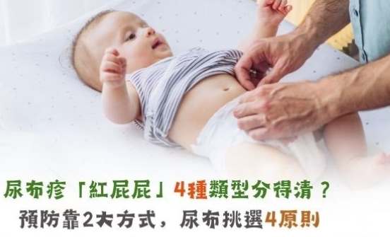 寶寶紅屁股護理 寶寶紅屁股護理