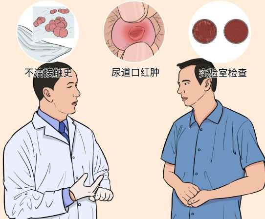 淋病治療