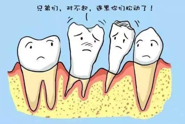 牙周病治療 牙周病治療