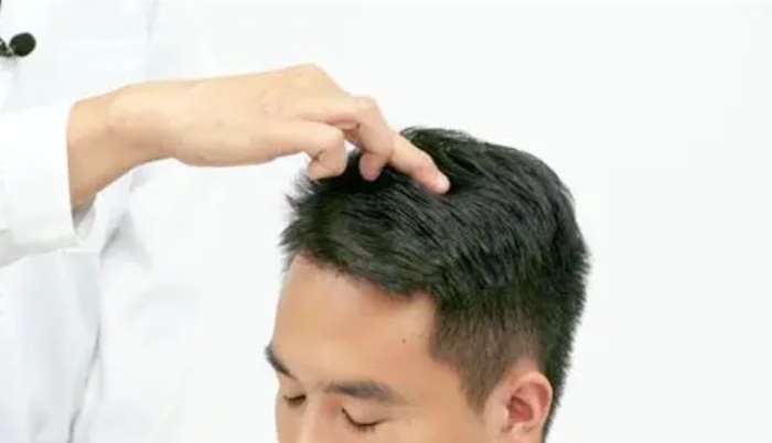 前頂穴位置 前頂穴位置