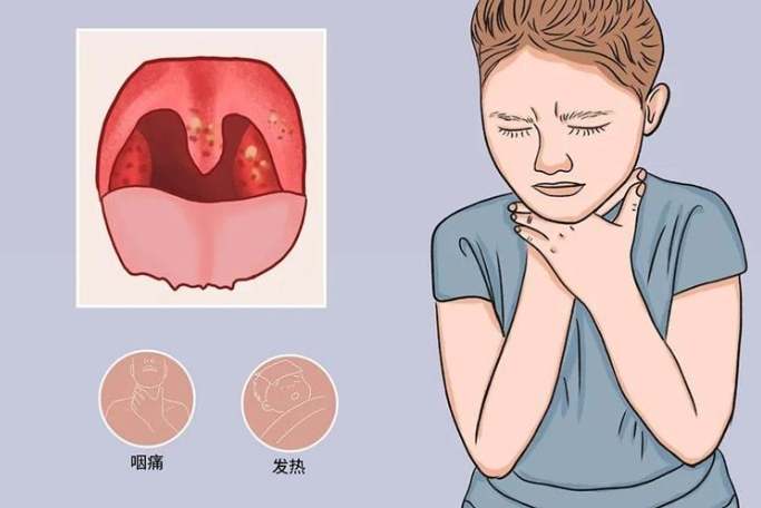 喉嚨痛恢復時間 喉嚨痛恢復時間