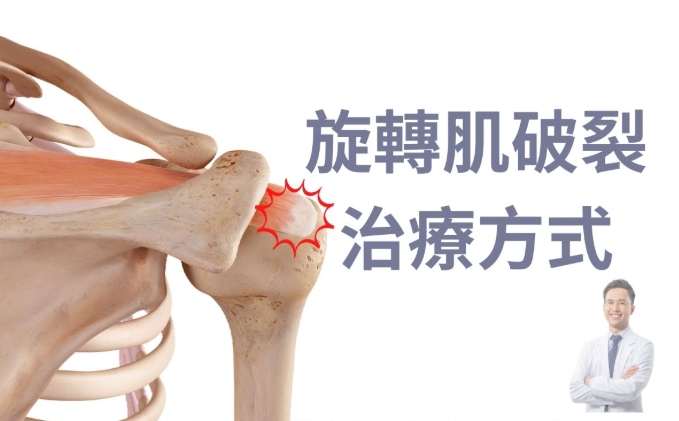 旋轉肌手術價格 旋轉肌手術價格