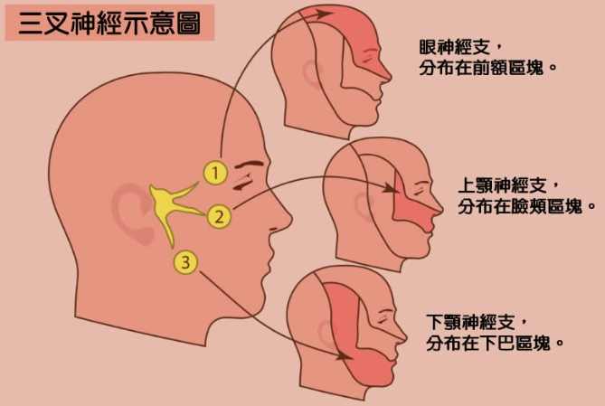 神經痛治療