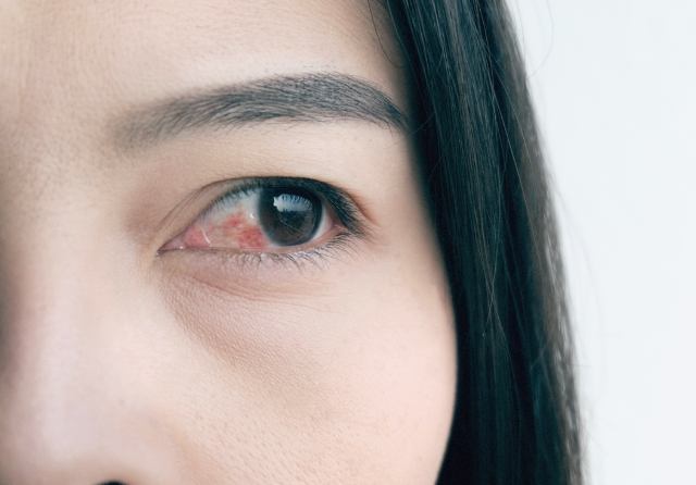 眼中風治療 眼中風治療