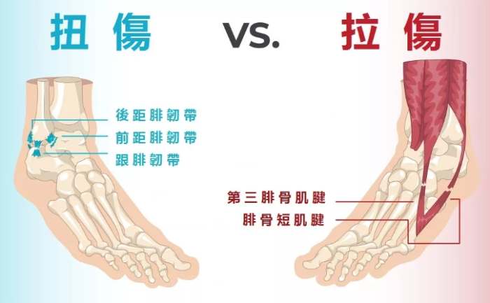 腳翻船恢復時間 腳翻船恢復時間