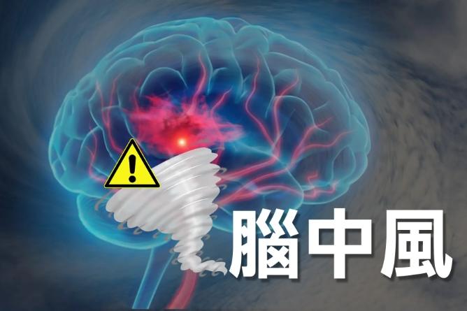 中風康復方法 中風康復方法