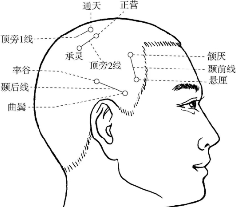 頭頂穴位按摩