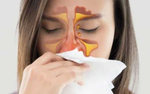 鼻竇炎治療 鼻竇炎治療