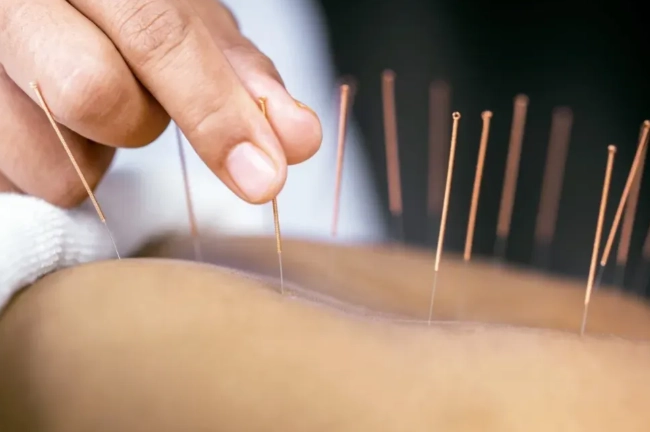 針灸疼痛副作用 針灸疼痛副作用