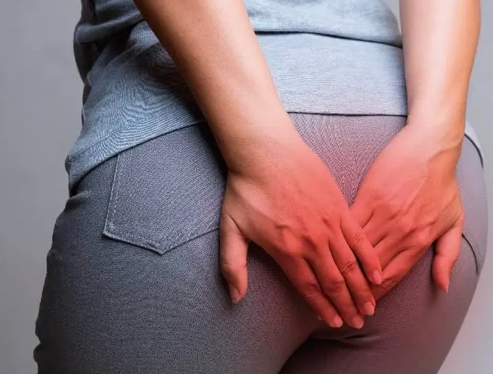 女性痔瘡原因 女性痔瘡原因