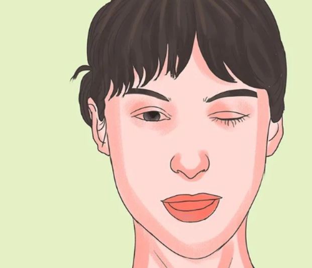 重症肌無力症病因
