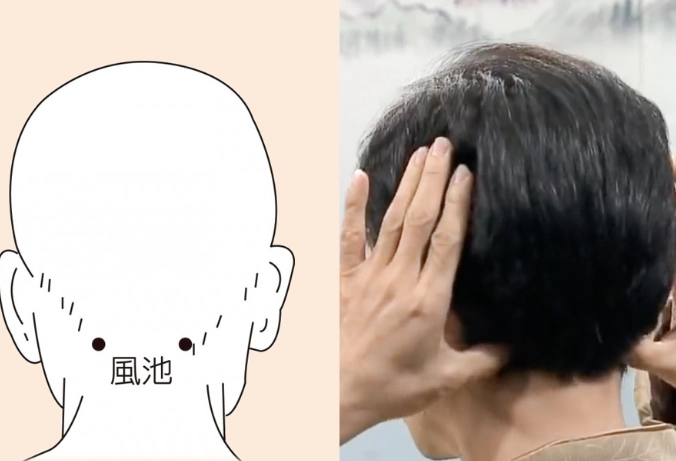 風池穴疼痛 風池穴疼痛