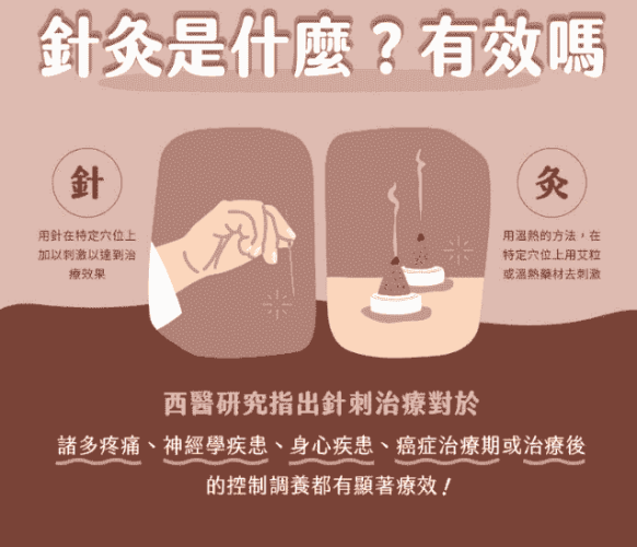 針灸作用 針灸作用