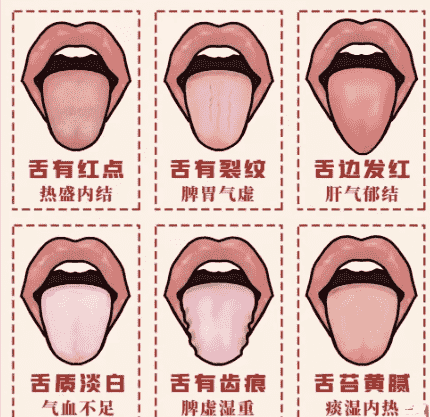舌診的內容 舌診的內容