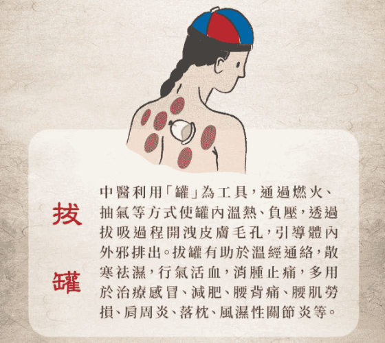 中醫拔罐原理