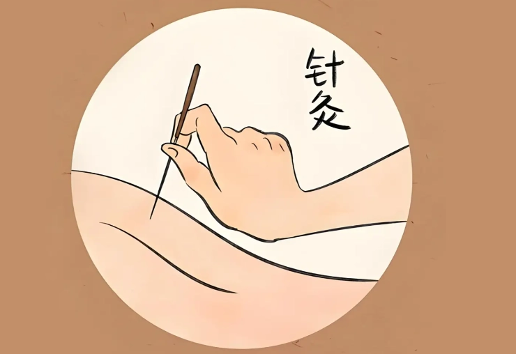 針灸前準備 針灸前準備