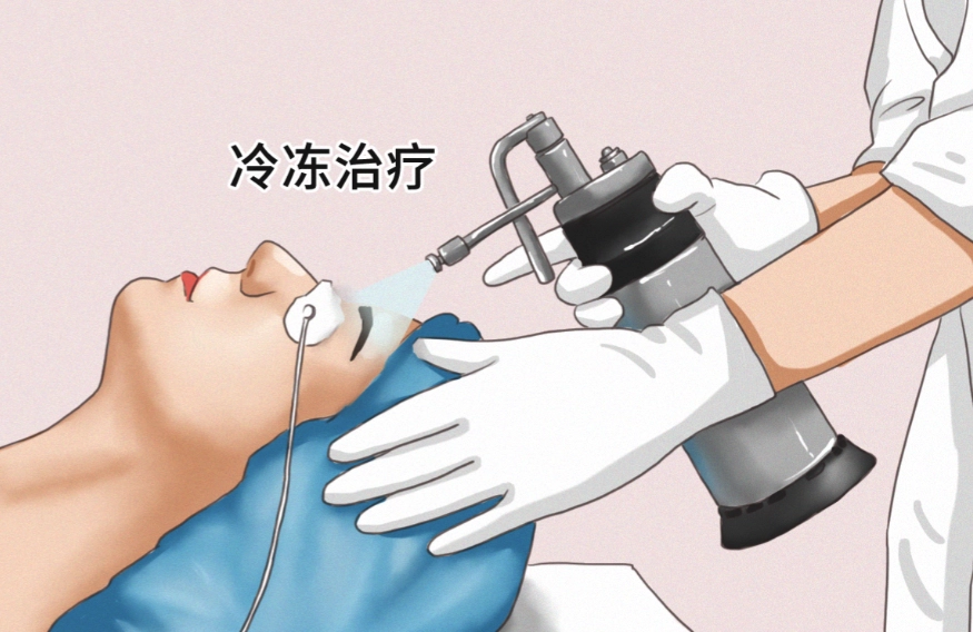 冷凍治療費用 冷凍治療費用