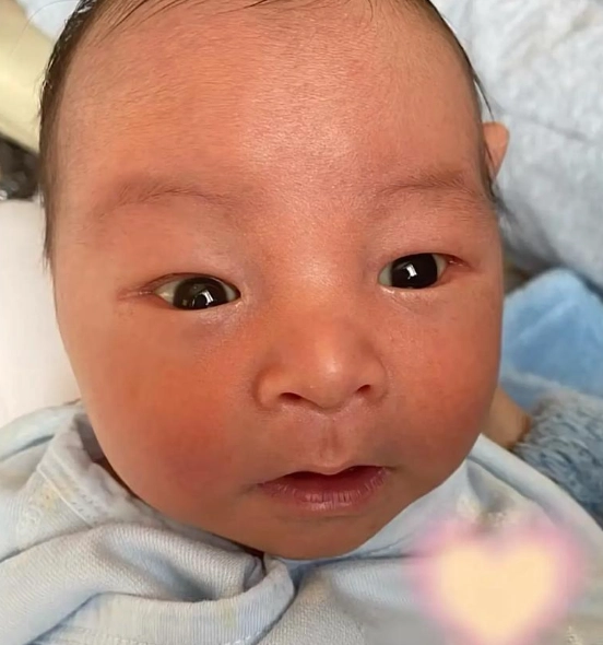 新生兒黃疸原因 新生兒黃疸原因